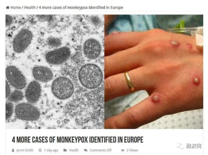 科普一下：新近流行的传染病——猴痘
