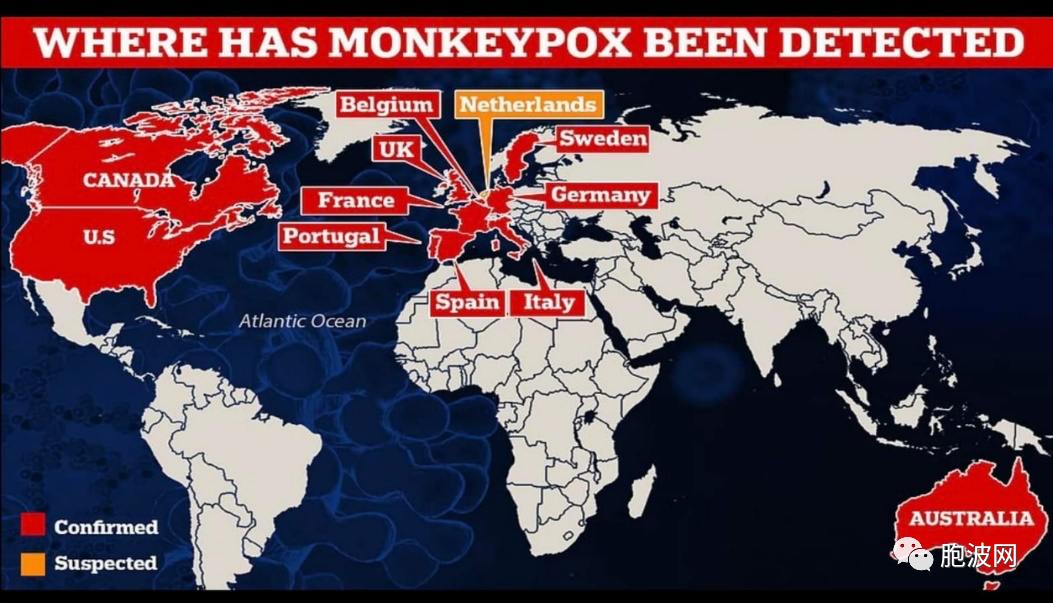 一波未平一波又起：​又一国际性灾难“猴痘”蔓延？